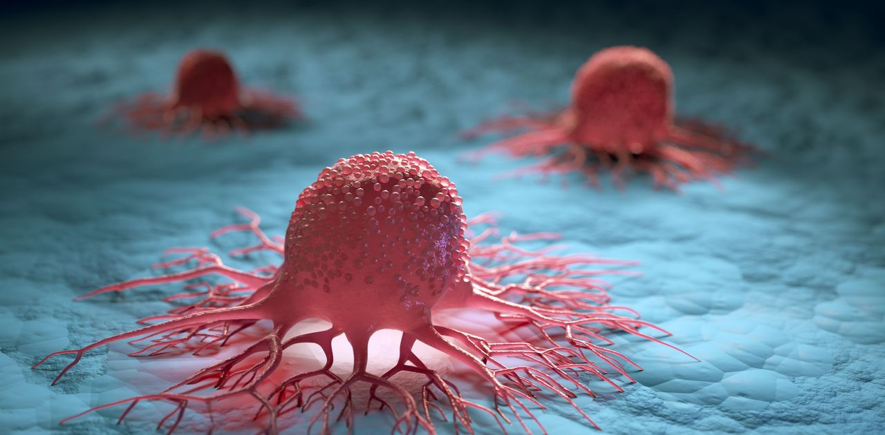 3D model of group of isolated cancer cells 