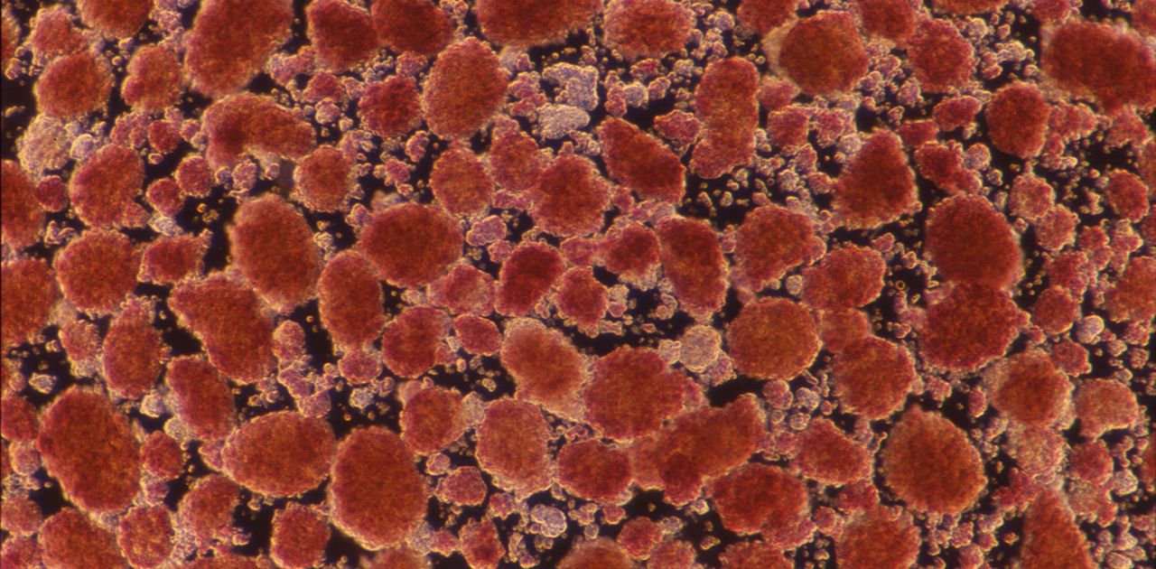 Microscopic image of Islet Cells