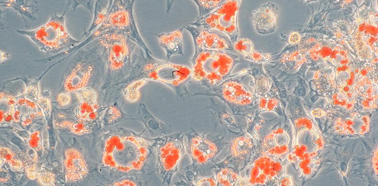 Microskopic Image of human adipocytes